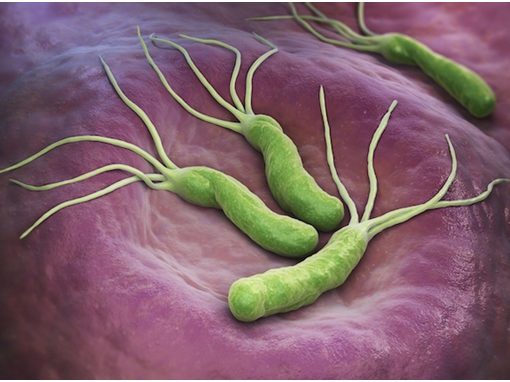Heliobacter pylori