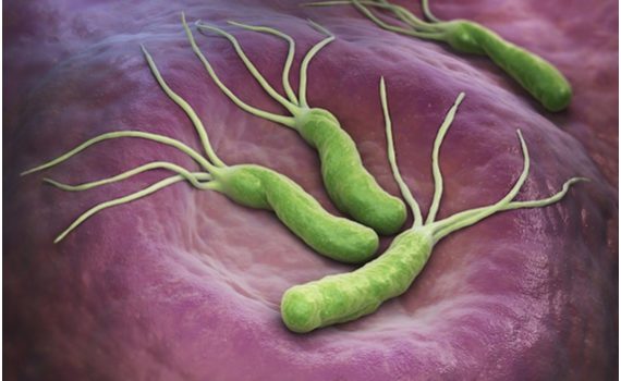 Heliobacter pylori